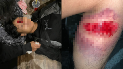 Demo Ojol Solo Ricuh, Dua Orang Tertembak